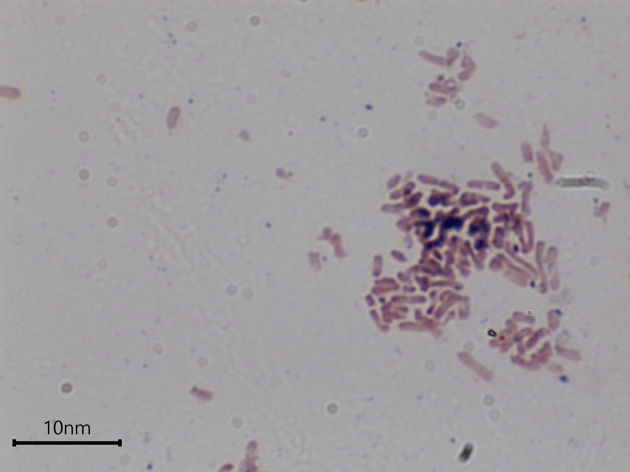 Gram staining