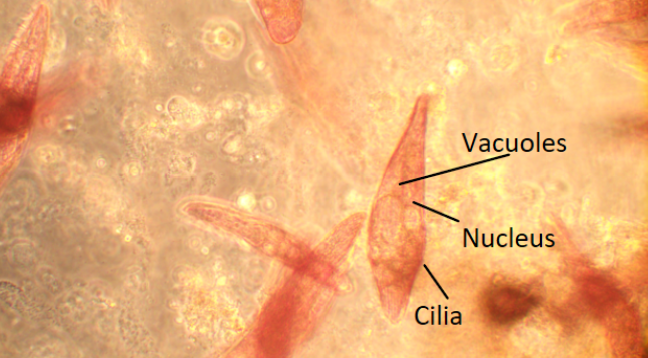 Phase contrast microscope
