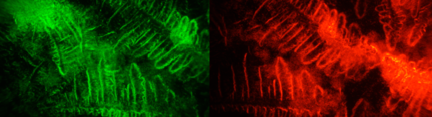 Fluorescence microscopy